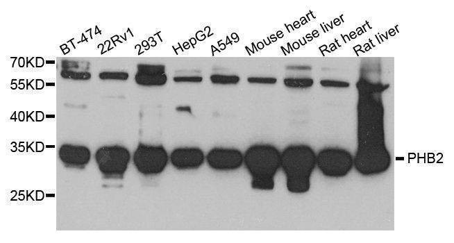 Anti-PHB2 Antibody