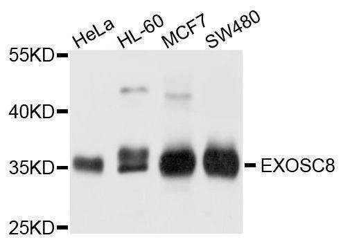 Anti-EXOSC8 Antibody