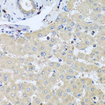 Anti-COTL1 Antibody