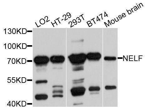 Anti-NSMF Antibody