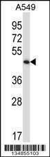 Anti-Phkg2 (N-term) Antibody