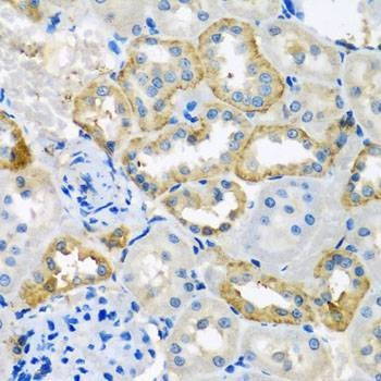 Anti-UQCR10 Antibody