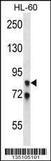 Anti-AKAP4 (N-term) Antibody