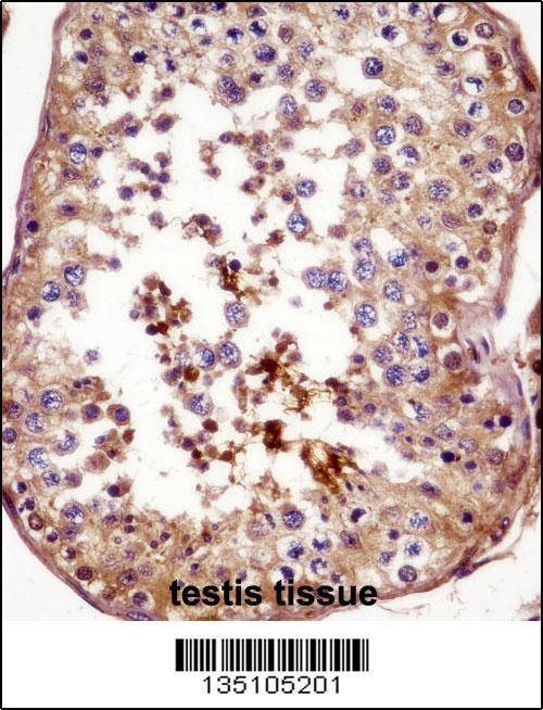 Anti-AKAP4 (N-term) Antibody