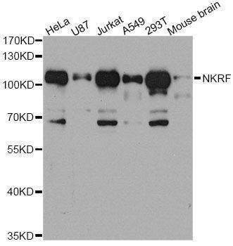Anti-NKRF Antibody
