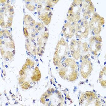 Anti-MRPL11 Antibody