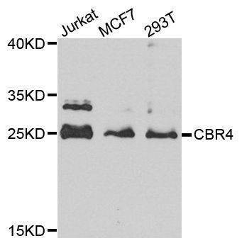 Anti-CBR4 Antibody