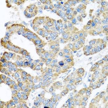 Anti-ATPIF1 Antibody