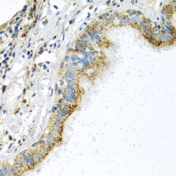 Anti-ATPIF1 Antibody