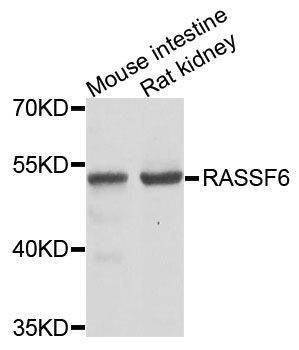 Anti-Mouse/Rat RASSF6 Antibody