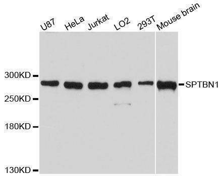 Anti-SPTBN1 Antibody