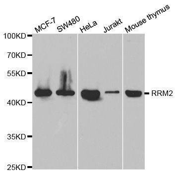 Anti-RRM2 Antibody