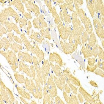 Anti-RRM2 Antibody