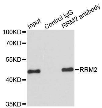 Anti-RRM2 Antibody