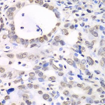 Anti-Nono Antibody