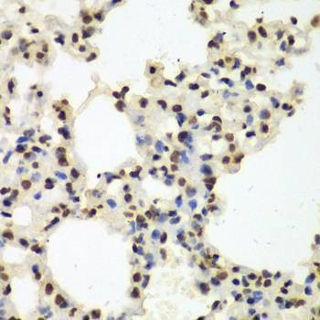 Anti-Nono Antibody