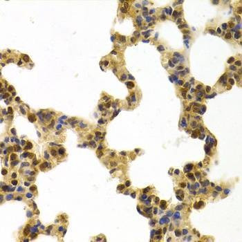 Anti-ERCC1 Antibody