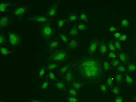 Anti-ERCC1 Antibody
