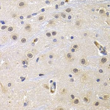 Anti-CCNG1 Antibody