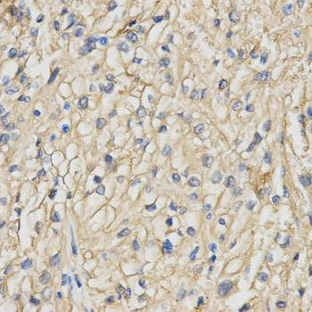 Anti-RACGAP1 Antibody