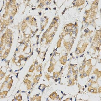 Anti-RACGAP1 Antibody