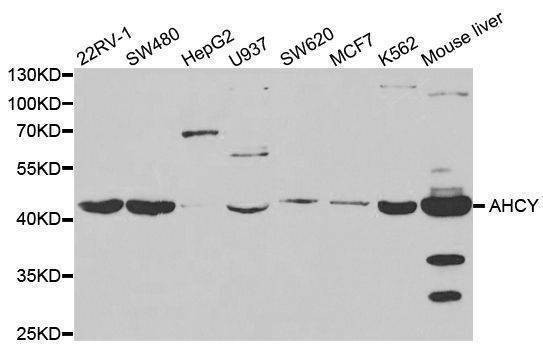 Anti-AHCY Antibody