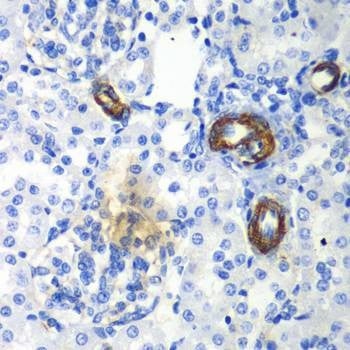 Anti-AIMP1 Antibody