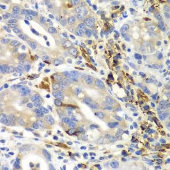 Anti-AIMP1 Antibody