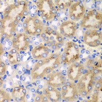 Anti-AIMP1 Antibody