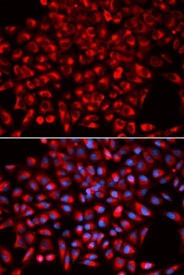 Anti-AIMP1 Antibody