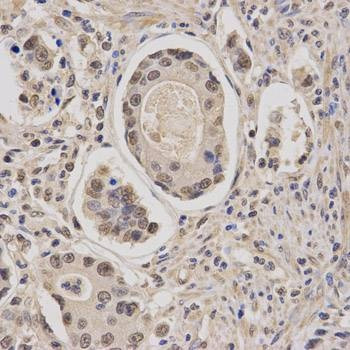 Anti-CBFB Antibody