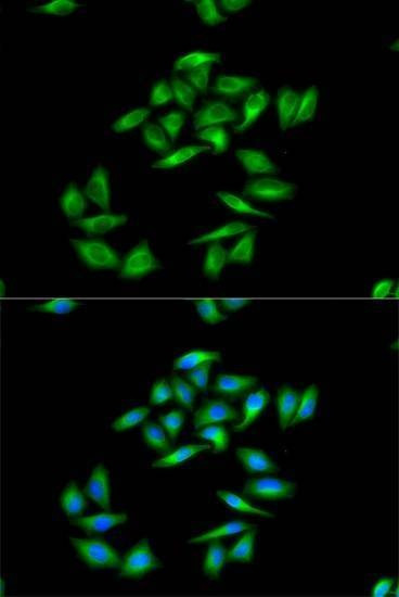 Anti-CPT1A Antibody
