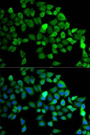 Anti-CUL2 Antibody