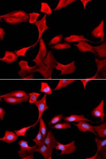 Anti-GCLM Antibody