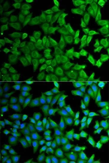 Anti-KLKB1 Antibody