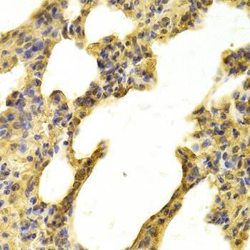 Anti-NDRG2 Antibody