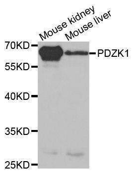 Anti-PDZK1 Antibody