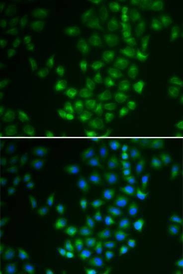 Anti-PRKACB Antibody