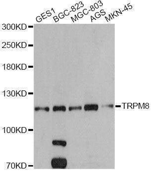 Anti-TRPM8 Antibody