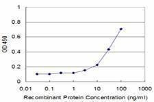 Anti-CNOT2 Antibody