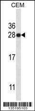 Anti-HMGB1 Antibody