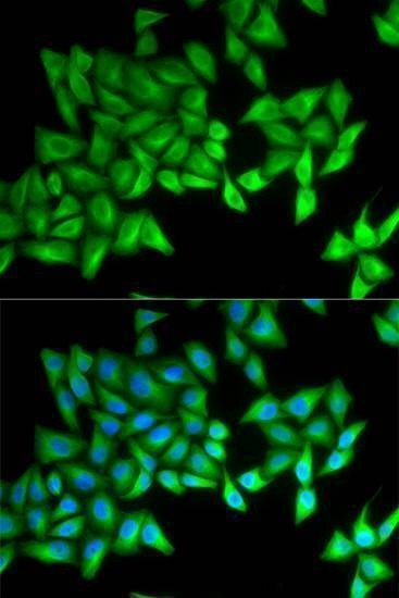 Anti-BPI Antibody