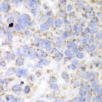 Anti-HADHA Antibody