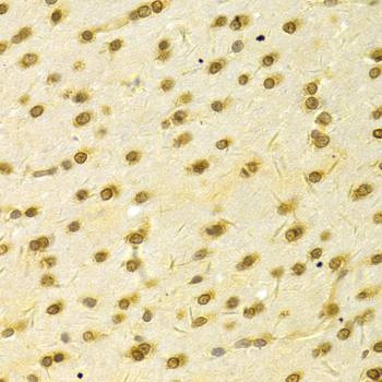Anti-HDGF Antibody