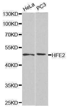 Anti-HFE2 Antibody