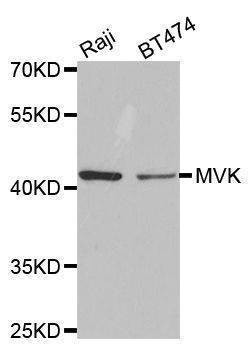Anti-MVK Antibody