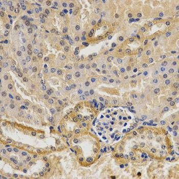Anti-MVK Antibody