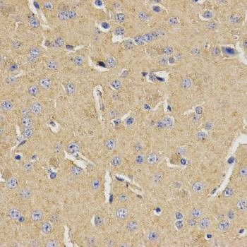 Anti-MVK Antibody