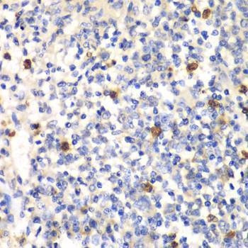 Anti-PSMD7 Antibody