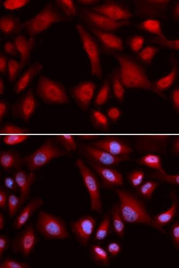 Anti-PSMD7 Antibody